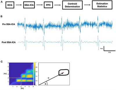 Ictal ECG-based assessment of sudden unexpected death in epilepsy